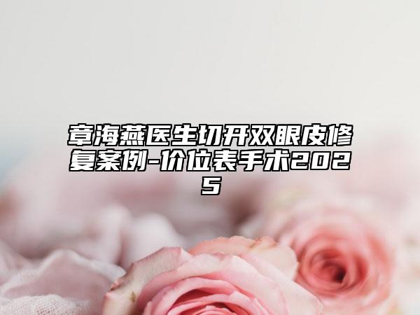 章海燕醫(yī)生切開(kāi)雙眼皮修復(fù)案例-價(jià)位表手術(shù)2025