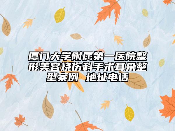 廈門大學附屬第一醫(yī)院整形美容燒傷科手術(shù)耳朵整型案例 地址電話