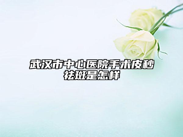 武漢市中心醫(yī)院手術(shù)皮秒祛斑是怎樣