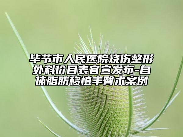畢節(jié)市人民醫(yī)院燒傷整形外科價目表官宣發(fā)布-自體脂肪移植豐臀術(shù)案例